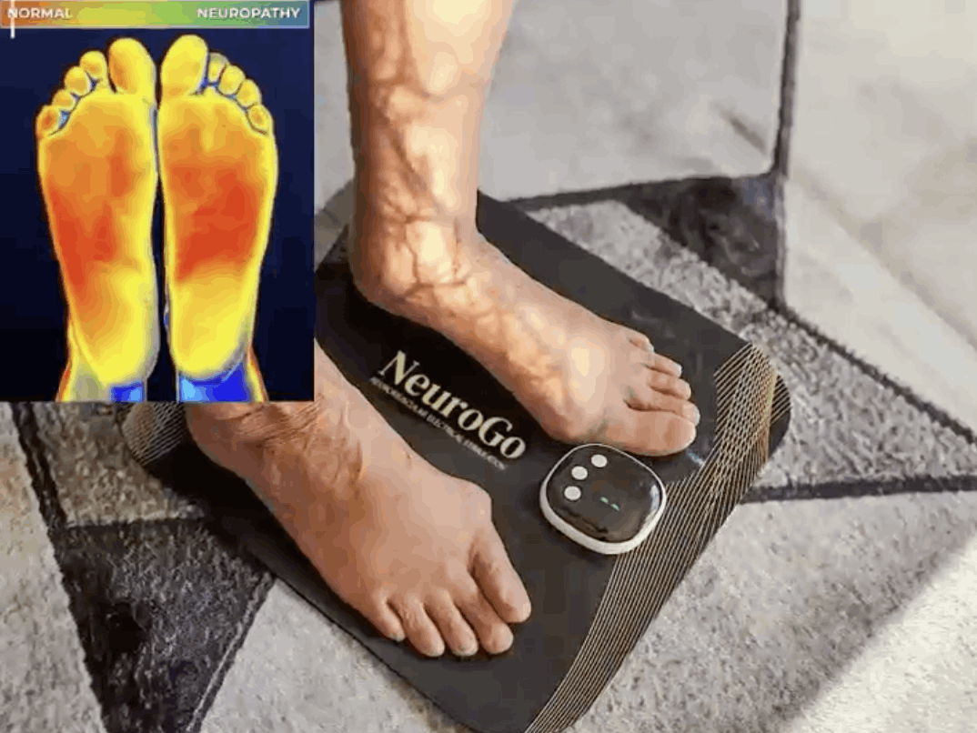 neurogo ems foot massager